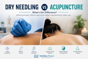 Dry Needling vs Acupuncture